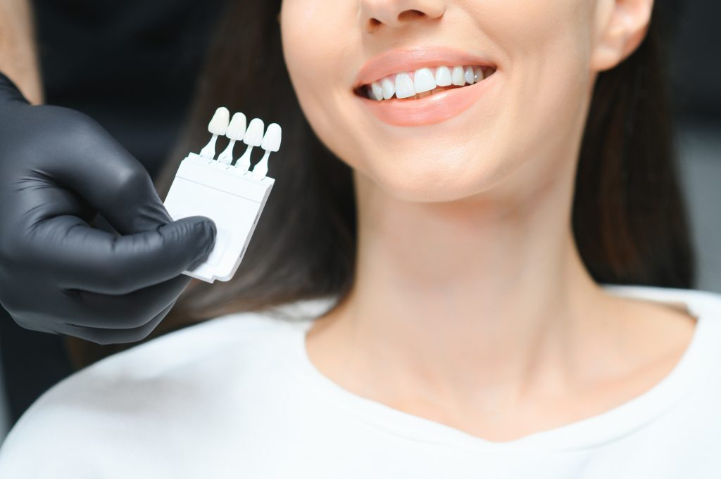 Teeth Whitening