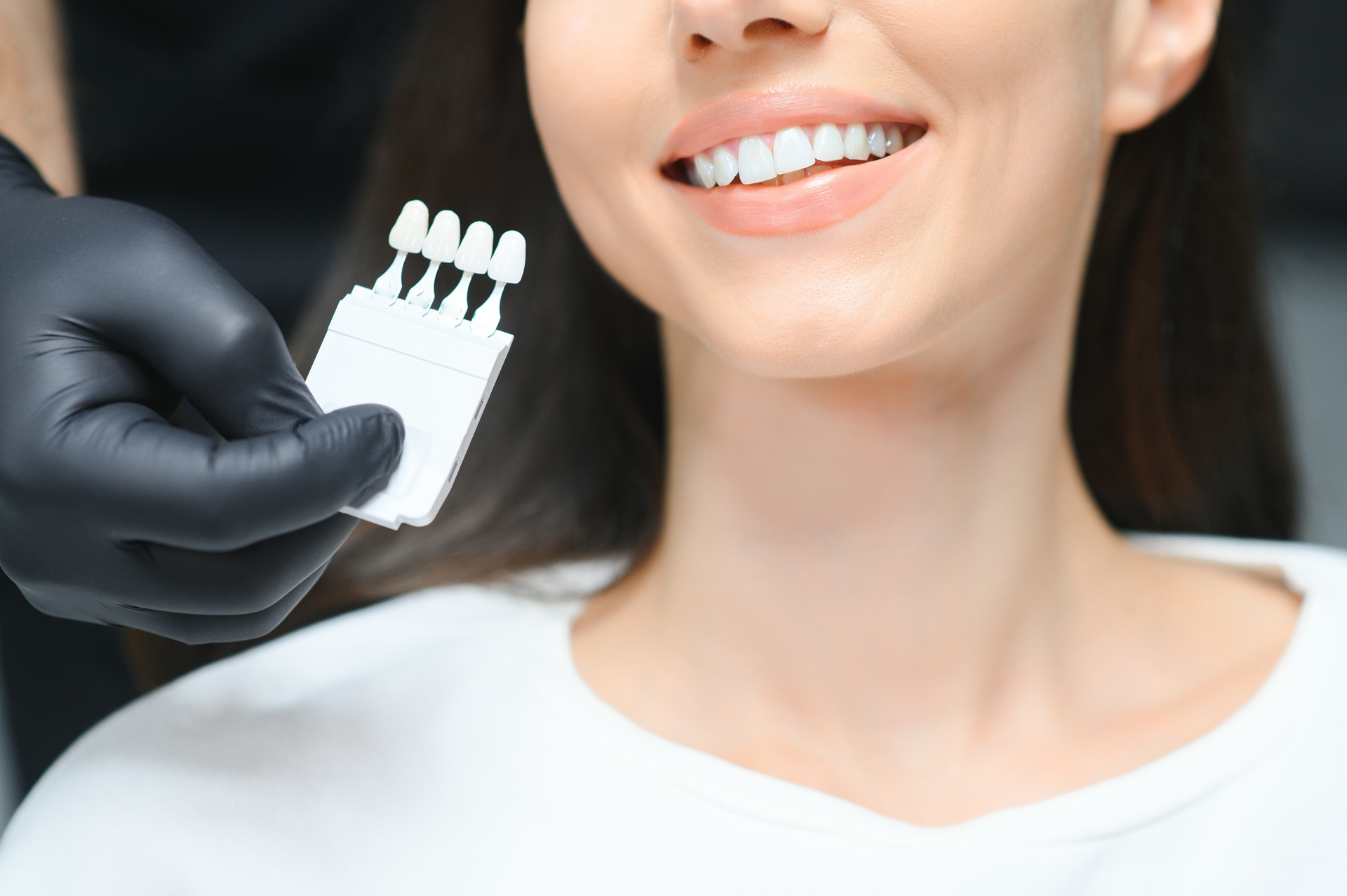 Teeth Whitening